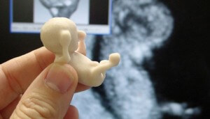 3D printed model of a 11 weeks old fetus
